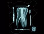 tooth xray 